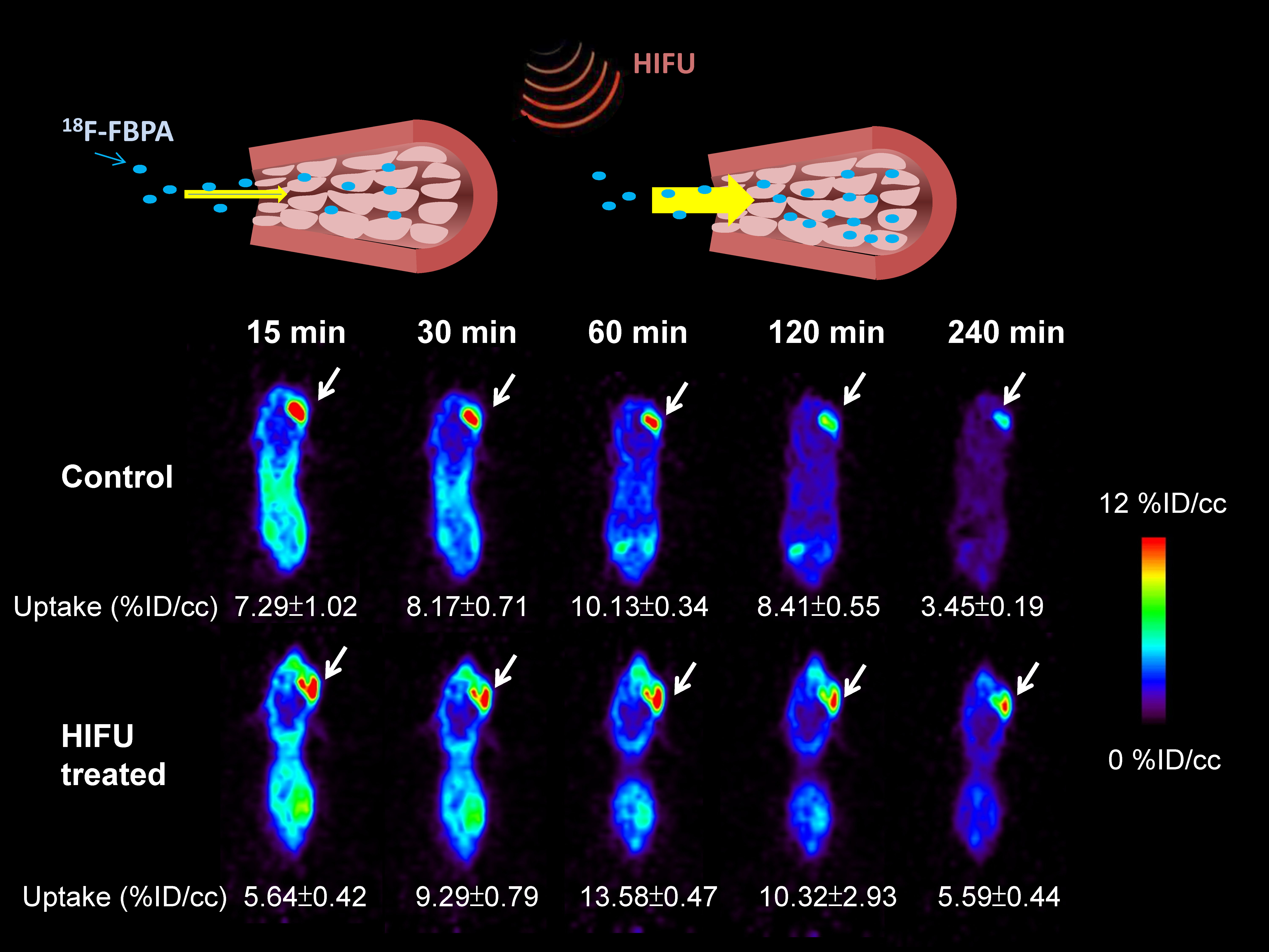 20140128 Figure of HIFU enhance FBPA-Fr delivery